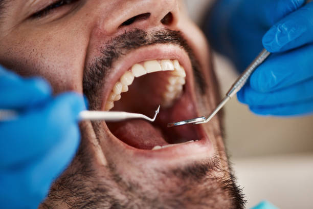 Best Emergency Dental Services for Seniors in Dobbs Ferry, NY